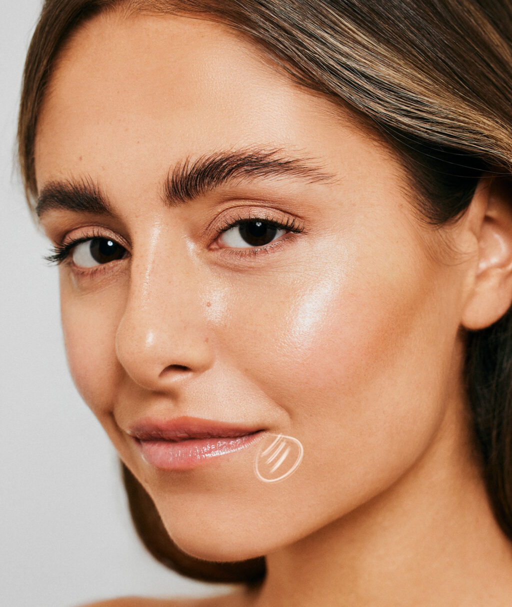 mondhoeken-hyaluronzuur