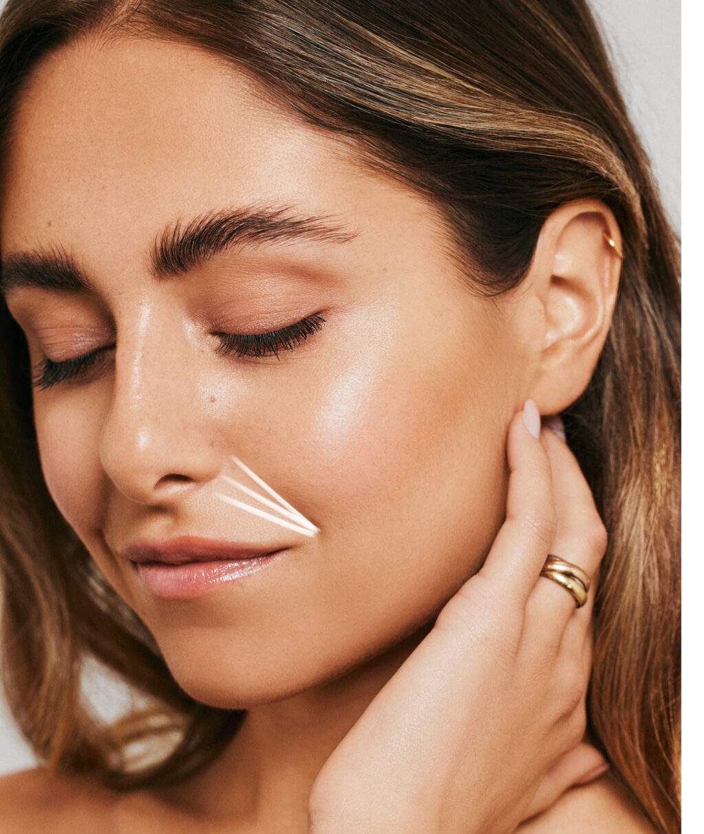 neuslippenplooi-filler