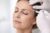 Botox preventief tegen rimpels